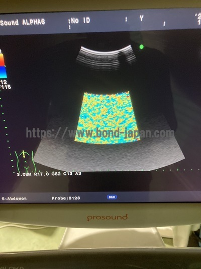 Color Doppler | HITACHI | Prosound α6
