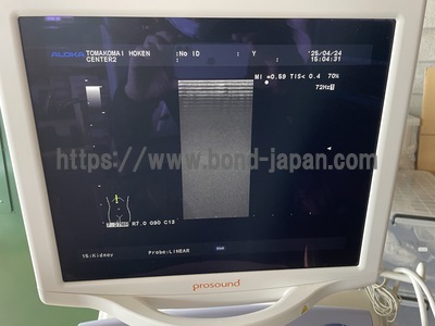Ultrasound System | HITACHI | Prosound α7
