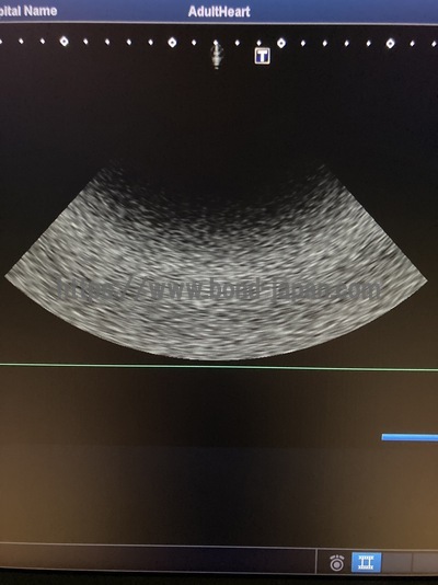 Color Doppler | CANON | Xario 200