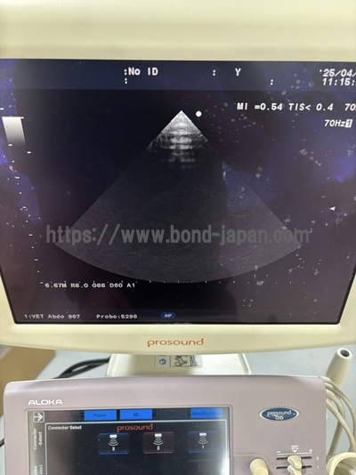 Color Doppler | HITACHI | Prosound α6