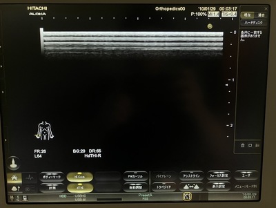Ultrasound&nbsp;|&nbsp;HITACHI&nbsp;|&nbsp;Noblus