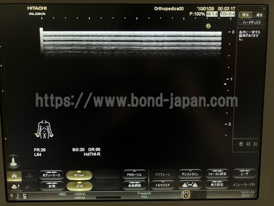 Ultrasound | HITACHI | Noblus