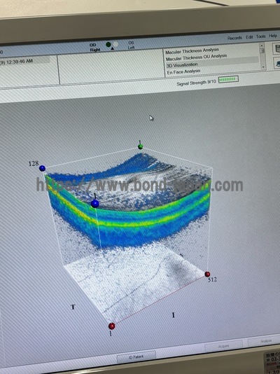 ** Great Conditioned OCT** | Carl Zeiss | Cirrus 500 HD-OCT Plus