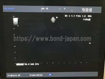 Ultrasound System | HITACHI | Prosound α7