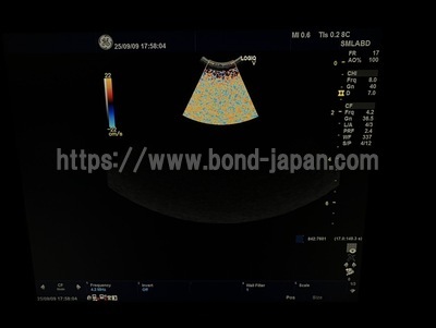 Color Doppler | GE | LOGIQ V5 Expert