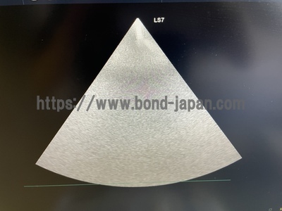 Color Doppler | GE | Logiq S7 Expert