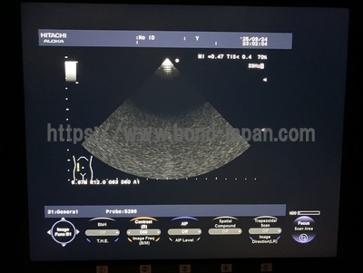 Color Doppler | HITACHI | F37