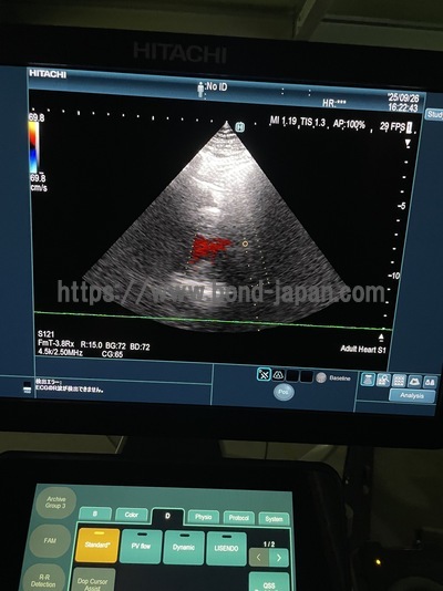Ultrasound System | FUJIFILM | ARIETTA 850