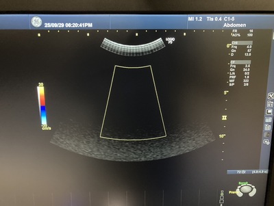 Ultrasound&nbsp;|&nbsp;GE&nbsp;|&nbsp;LOGIQ P9