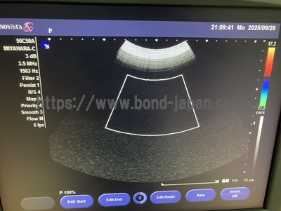 超音波診断装置 | 持田シーメンスメディカルシステム株式会社 | Sonovista FX PEの写真