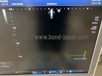 Color Doppler | CANON | TUS-X100 Xario 100