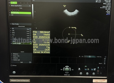 Ultrasound | GE | Voluson P8 BT18