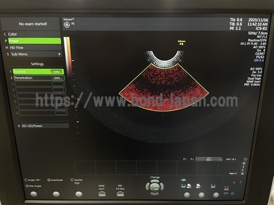 Ultrasound | GE | Voluson P8 BT18