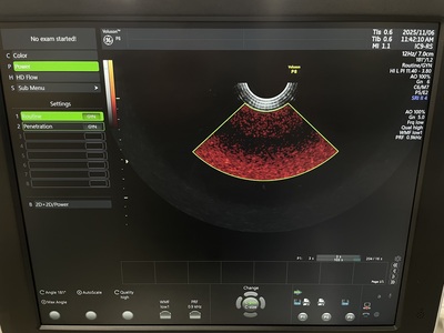 Ultrasound&nbsp;|&nbsp;GE&nbsp;|&nbsp;Voluson P8 BT18