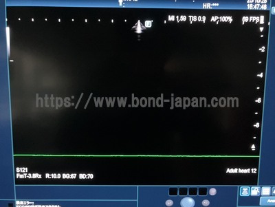 Ultrasound System&nbsp;|&nbsp;FUJIFILM&nbsp;|&nbsp;ARIETTA 850