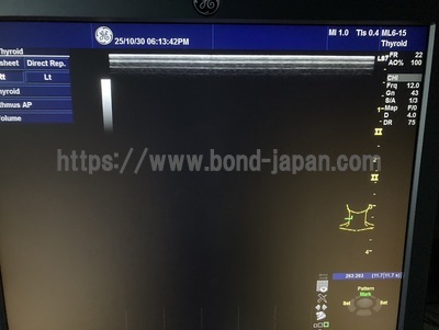 Color Doppler | GE | Logiq S7 Expert