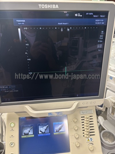 Color Doppler | CANON | Aplio 400