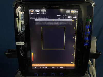 Color Doppler | GE | Venue 40