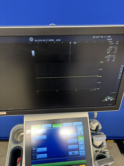 Ultrasound&nbsp;|&nbsp;GE&nbsp;|&nbsp;LOGIQ P9