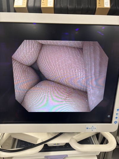 Video Gastroscope&nbsp;|&nbsp;OLYMPUS&nbsp;|&nbsp;GIF-H190N