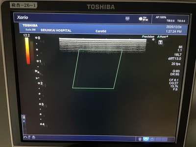 Color Doppler&nbsp;|&nbsp;CANON&nbsp;|&nbsp;Xario 200