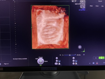 4D Ultrasound&nbsp;|&nbsp;GE&nbsp;|&nbsp;Voluson E10 BT19