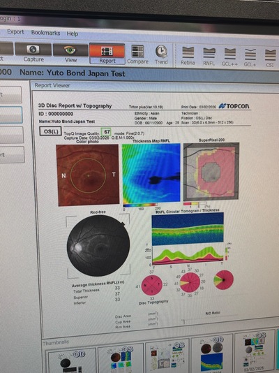 OCT With Angiography&nbsp;|&nbsp;TOPCON&nbsp;|&nbsp;DRI OCT Triton plus