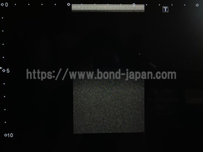 超音波診断装置/カラードプラ | キャノンメディカル株式会社 | Aplio 300の写真