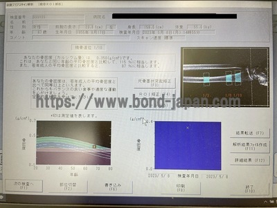 X線骨密度測定装置 | 富士フィルムヘルスケア株式会社 | ALPHYS Aの写真