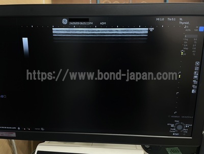 Ultrasound | GE | LOGIQ P9