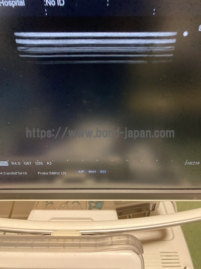 Color Doppler | HITACHI | F75
