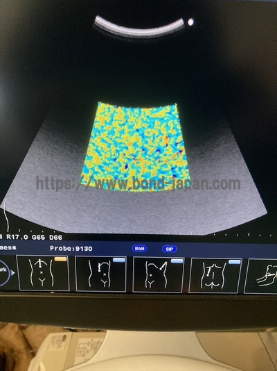 Color Doppler | HITACHI | F37