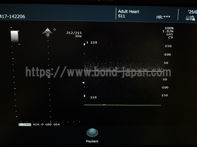 Ultrasound System | FUJIFILM | ARIETTA 50