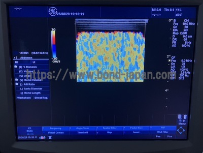 Color Doppler | GE | LOGIQ P5