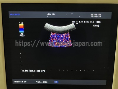 Ultrasound System | HITACHI | Prosound α7