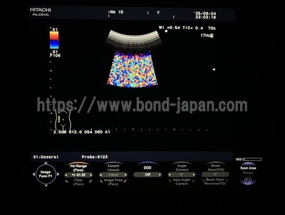 Color Doppler | HITACHI | F37
