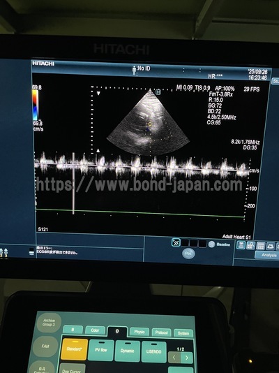 Ultrasound System | FUJIFILM | ARIETTA 850