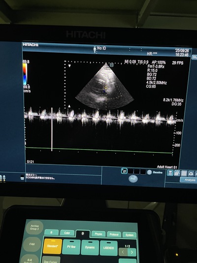 Ultrasound System&nbsp;|&nbsp;FUJIFILM&nbsp;|&nbsp;ARIETTA 850