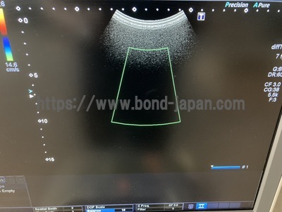 Color Doppler | CANON | TUS-X100 Xario 100