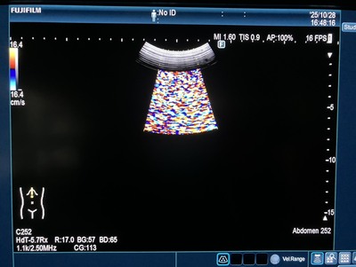 Ultrasound System&nbsp;|&nbsp;FUJIFILM&nbsp;|&nbsp;ARIETTA 850