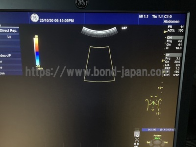Color Doppler | GE | Logiq S7 Expert