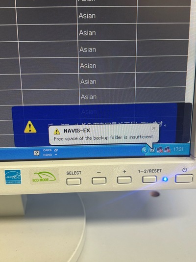 Optical Coherence Tomography ・OCT&nbsp;|&nbsp;NIDEK&nbsp;|&nbsp;RS-3000 Lite