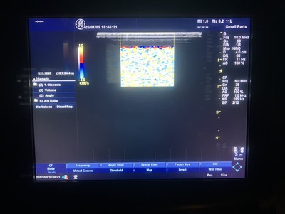 Color Doppler&nbsp;|&nbsp;GE&nbsp;|&nbsp;LOGIQ P5