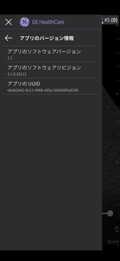 汎用超音波画像診断装置&nbsp;|&nbsp;GEヘルスケア・ジャパン株式会社&nbsp;|&nbsp;Vscan Air SLの写真