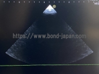 Color Doppler | HITACHI | Hi Vision Avius