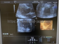 4D Ultrasound | GE | Voluson E8
