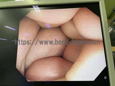 上部消化管汎用ビデオスコープ | オリンパス | GIF-HQ290の写真