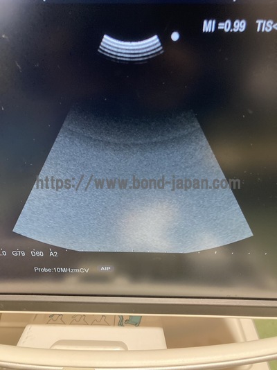 Color Doppler | HITACHI | F75