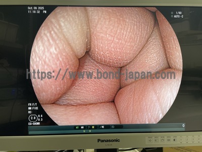 Gastroscope | FUJIFILM | EG-590WR
