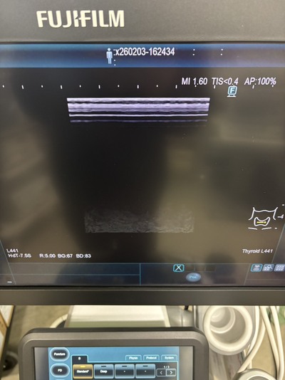 超音波診断装置&nbsp;|&nbsp;富士フイルムメディカル&nbsp;|&nbsp;ARIETTA 650 DeepInsightの写真